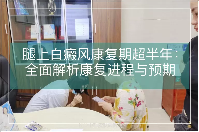 腿上白癜风康复期超半年:全面解析康复进程与预期