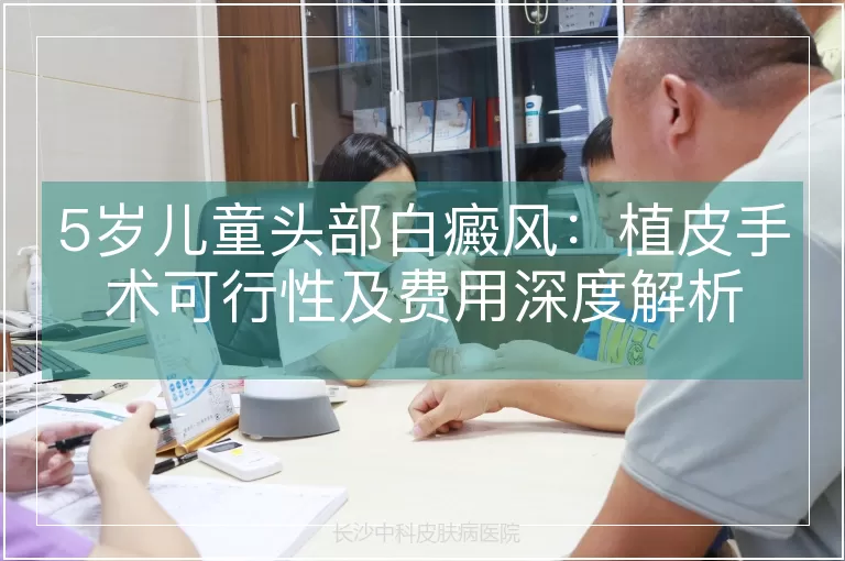 5岁儿童头部白癜风：植皮手术可行性及费用深度解析