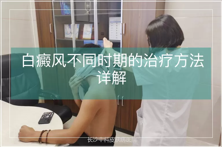 白癜风不同时期的治疗方法详解