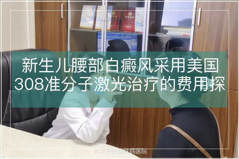 新生儿腰部白癜风采用美国308准分子激光治疗的费用探讨