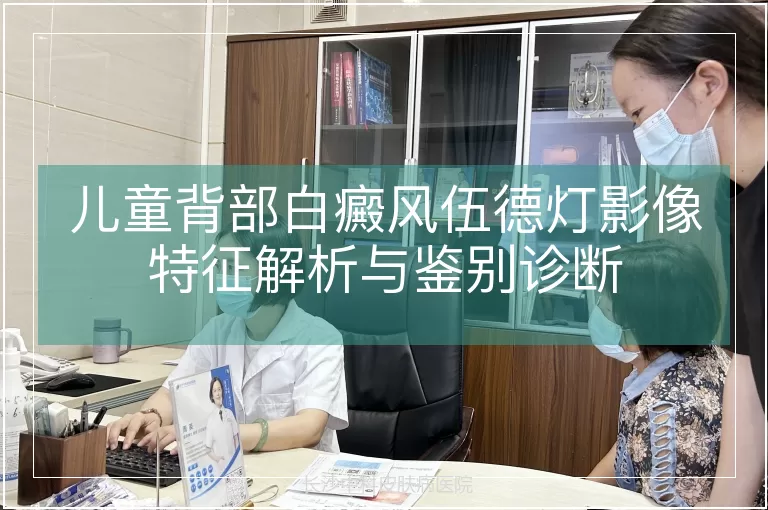 儿童背部白癜风伍德灯影像特征解析与鉴别诊断