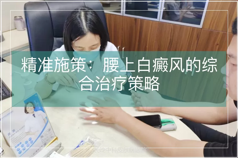 精准施策：腰上白癜风的综合治疗策略