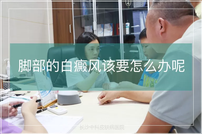 脚部的白癜风该要怎么办呢