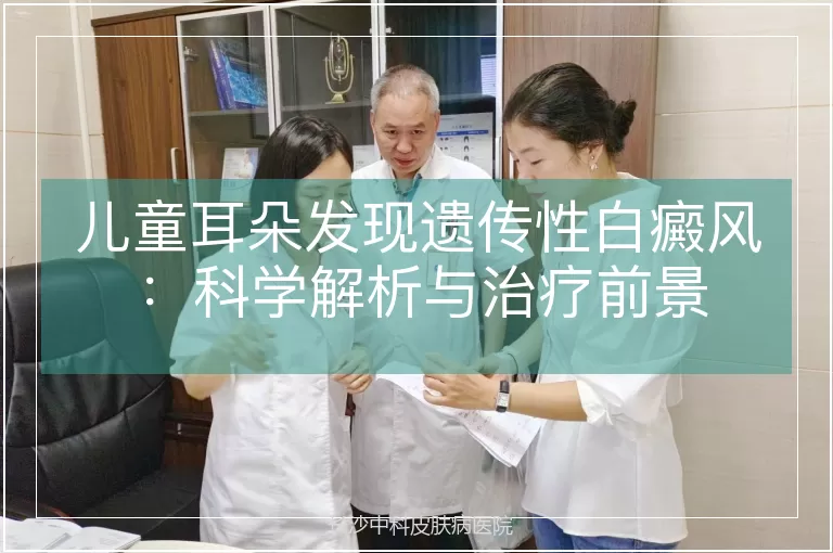 儿童耳朵发现遗传性白癜风：科学解析与治疗前景