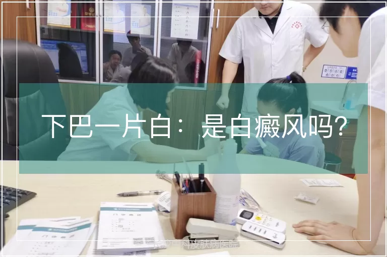 下巴一片白：是白癜风吗？