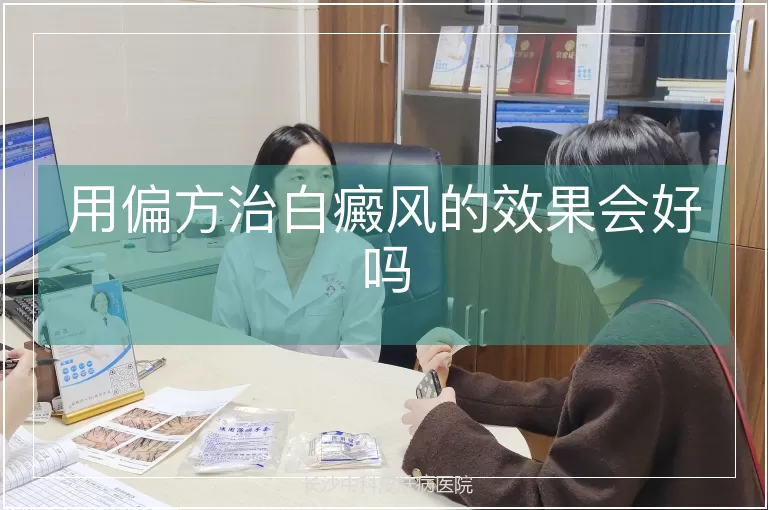 用偏方治白癜风的效果会好吗