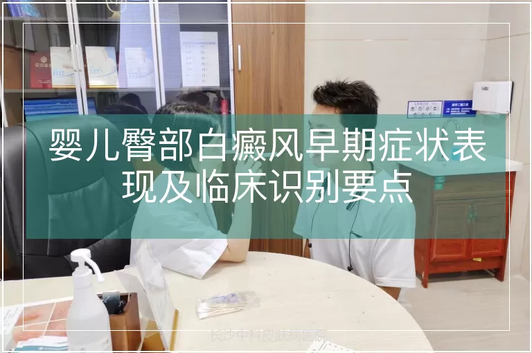婴儿臀部白癜风早期症状表现及临床识别要点