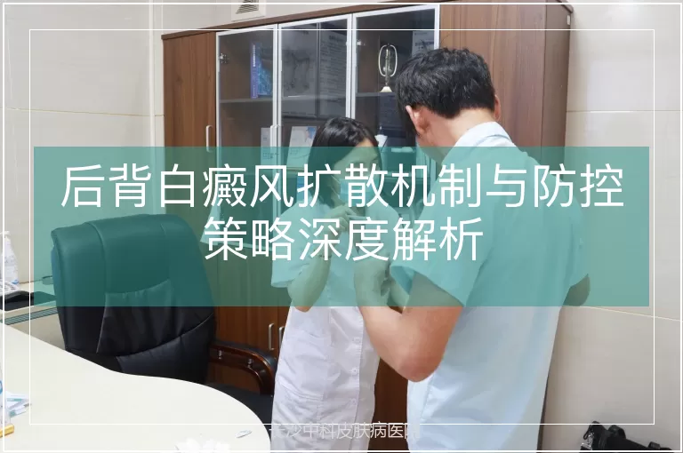 后背白癜风扩散机制与防控策略深度解析