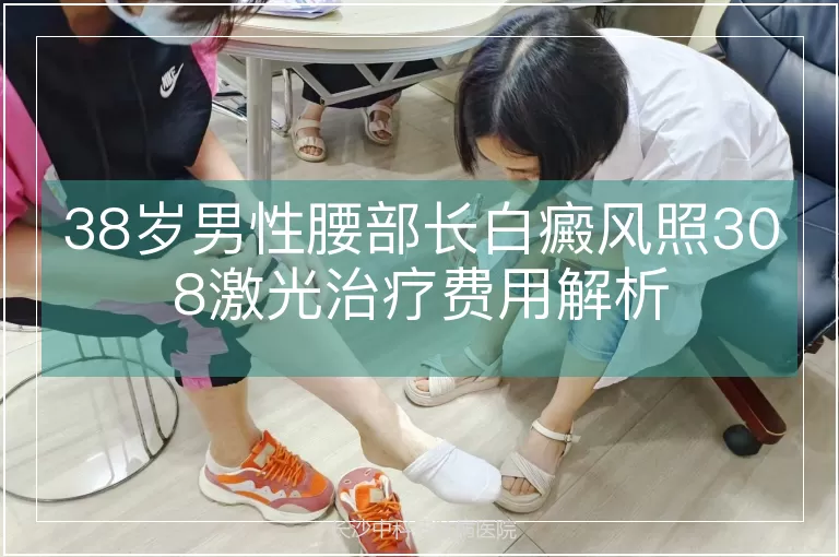 38岁男性腰部长白癜风照308激光治疗费用解析