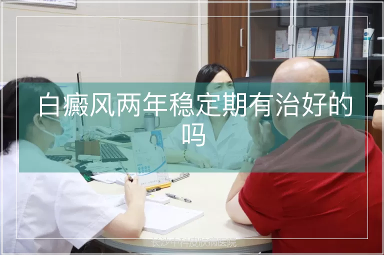 白癜风两年稳定期有治好的吗