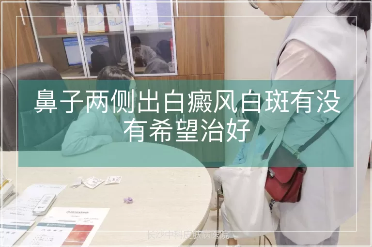 鼻子两侧出白癜风白斑有没有希望治好