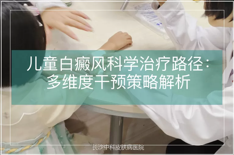 儿童白癜风科学治疗路径：多维度干预策略解析