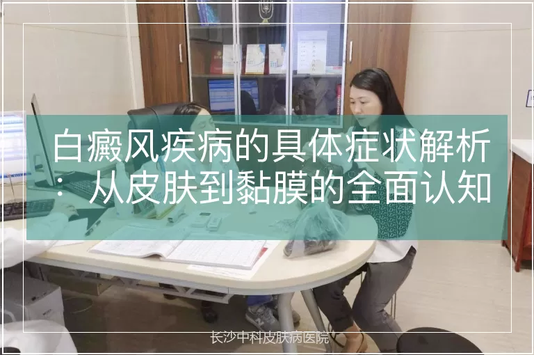 白癜风疾病的具体症状解析：从皮肤到黏膜的全面认知