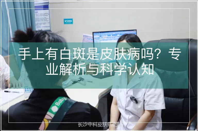手上有白斑是皮肤病吗？专业解析与科学认知