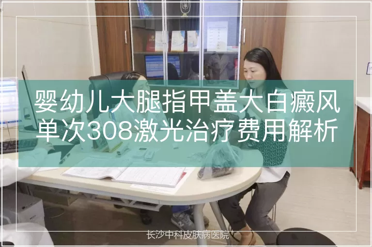 婴幼儿大腿指甲盖大白癜风单次308激光治疗费用解析
