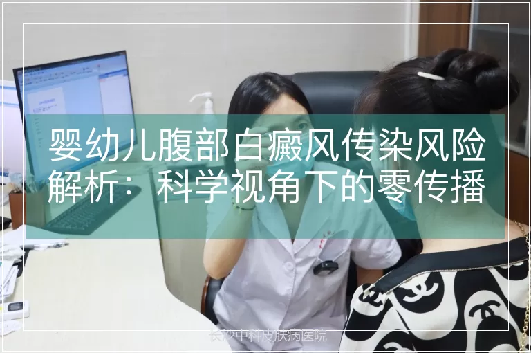 婴幼儿腹部白癜风传染风险解析:科学视角下的零传播机制