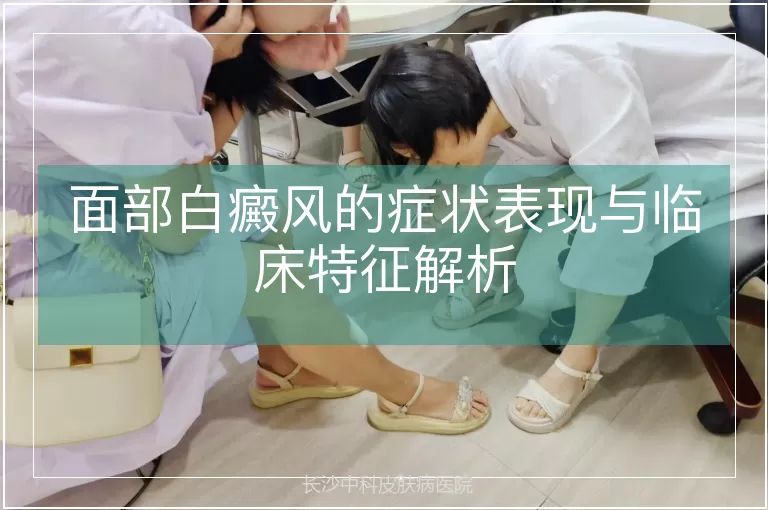 面部白癜风的症状表现与临床特征解析
