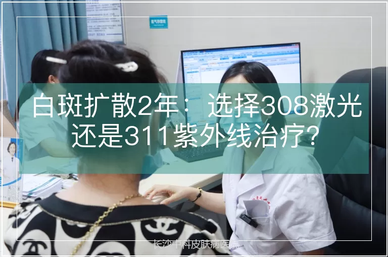 白斑扩散2年：选择308激光还是311紫外线治疗？