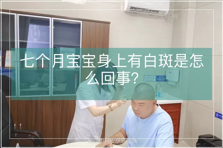 七个月宝宝身上有白斑是怎么回事？