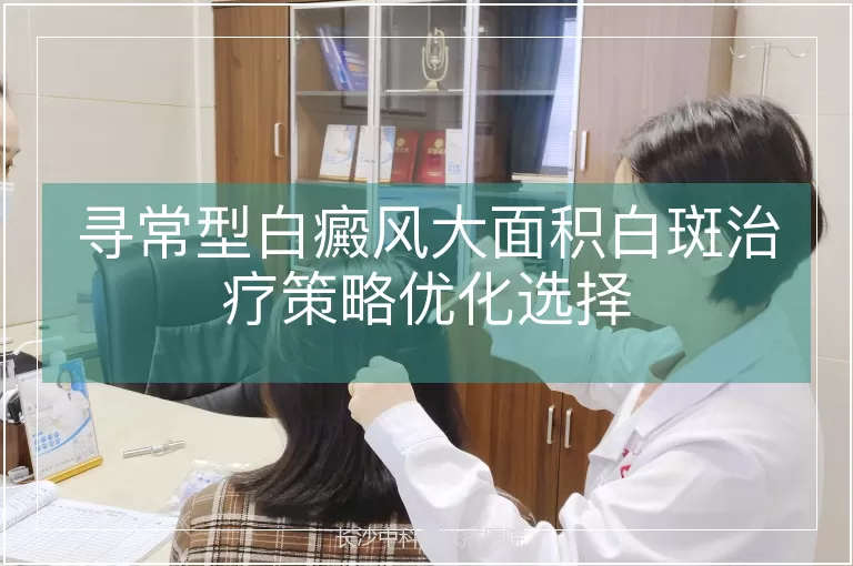 寻常型白癜风大面积白斑治疗策略优化选择