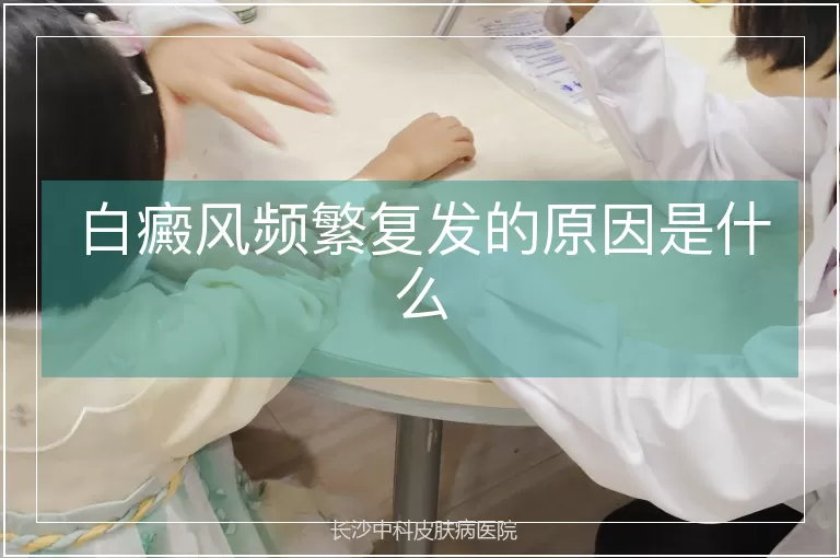 白癜风频繁复发的原因是什么