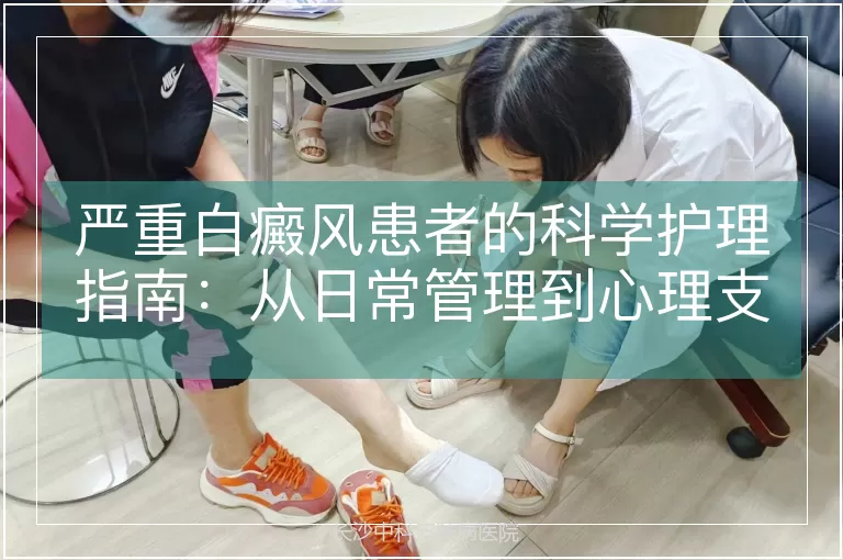 严重白癜风患者的科学护理指南：从日常管理到心理支持