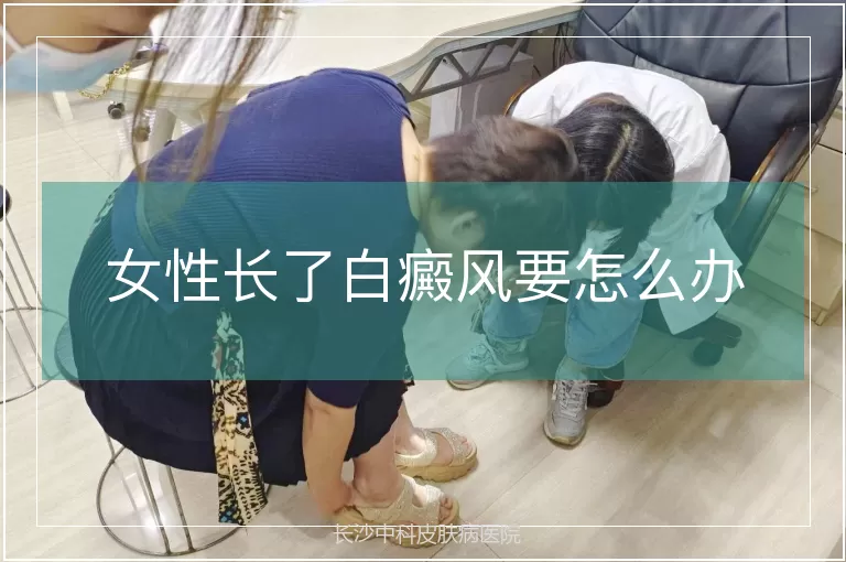 女性长了白癜风要怎么办