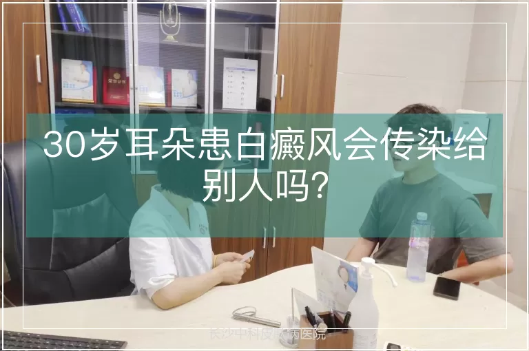 30岁耳朵患白癜风会传染给别人吗？
