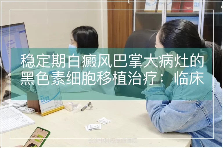 稳定期白癜风巴掌大病灶的黑色素细胞移植治疗：临床观察与效果评估