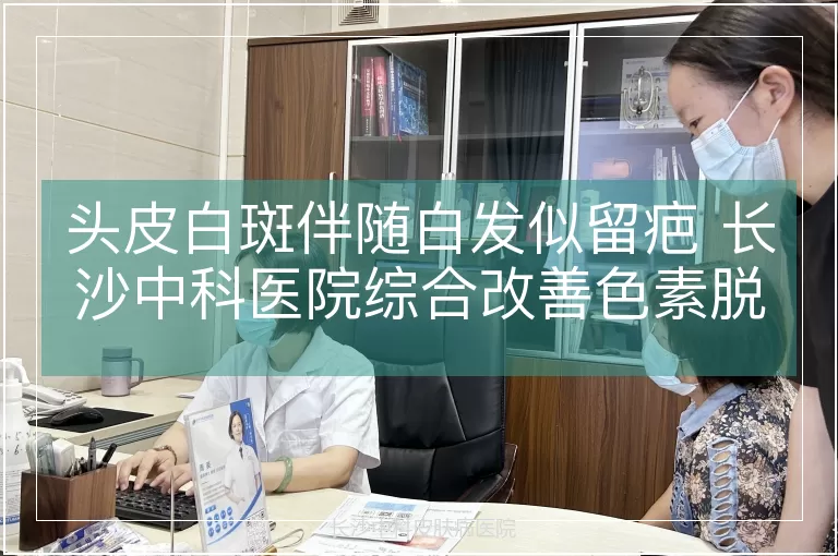 头皮白斑伴随白发似留疤 长沙中科医院综合改善色素脱失