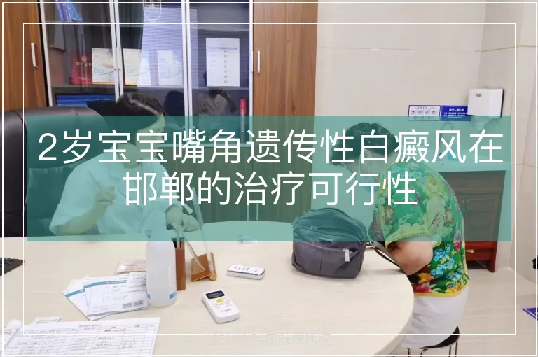 2岁宝宝嘴角遗传性白癜风在邯郸的治疗可行性
