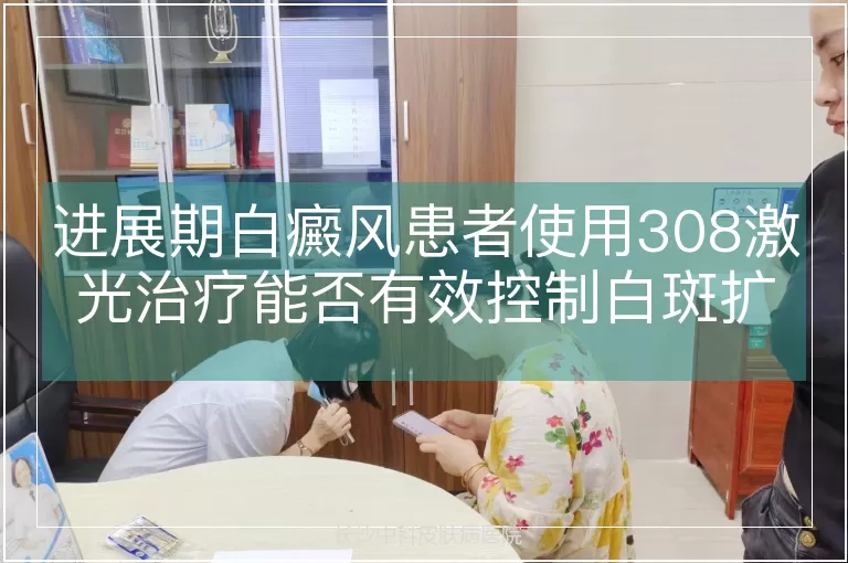 进展期白癜风患者使用308激光治疗能否有效控制白斑扩散？