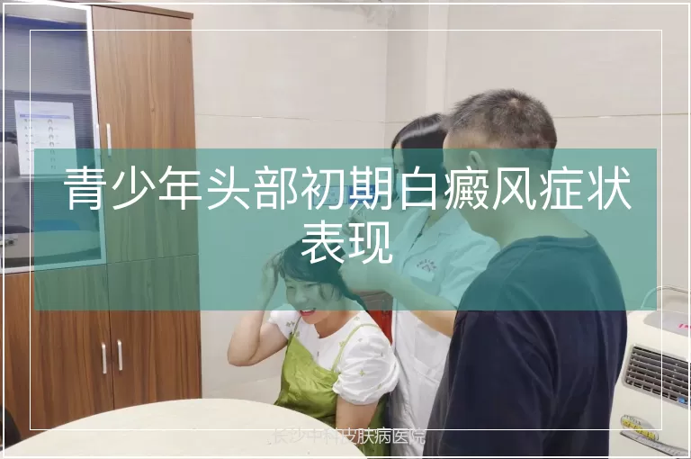 青少年头部初期白癜风症状表现