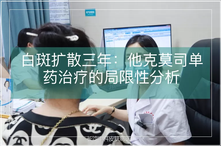 白斑扩散三年：他克莫司单药治疗的局限性分析