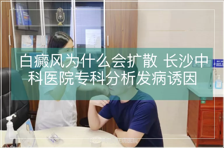 白癜风为什么会扩散 长沙中科医院专科分析发病诱因