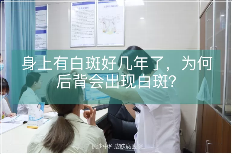 身上有白斑好几年了，为何后背会出现白斑？