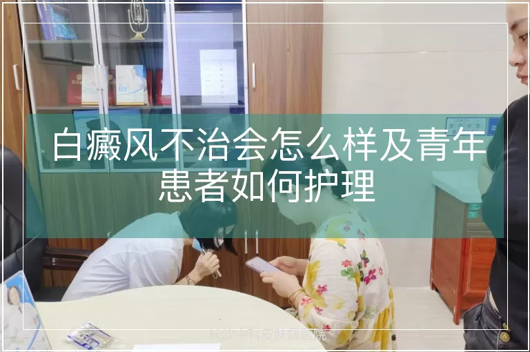 白癜风不治会怎么样及青年患者如何护理