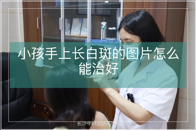 小孩手上长白斑的图片怎么能治好
