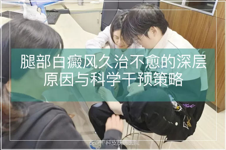 腿部白癜风久治不愈的深层原因与科学干预策略