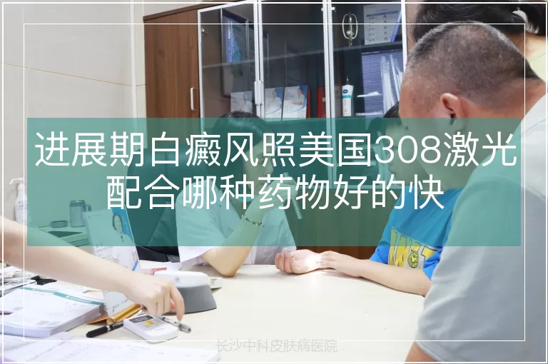 进展期白癜风照美国308激光配合哪种药物好的快