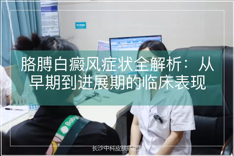 胳膊白癜风症状全解析:从早期到进展期的临床表现