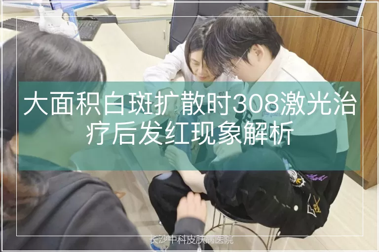 大面积白斑扩散时308激光治疗后发红现象解析