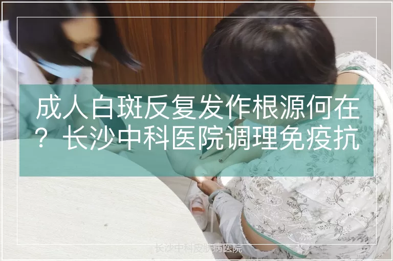 成人白斑反复发作根源何在？长沙中科医院调理免疫抗复发