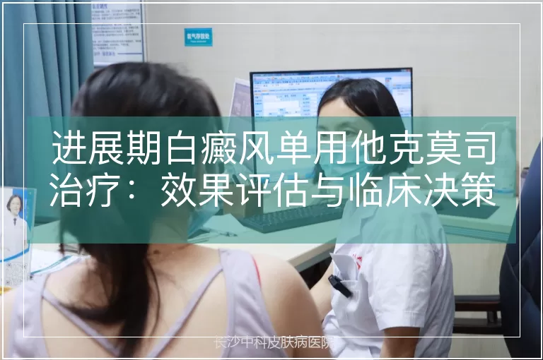 进展期白癜风单用他克莫司治疗：效果评估与临床决策分析
