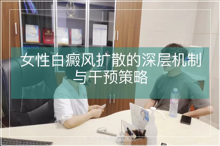 女性白癜风扩散的深层机制与干预策略