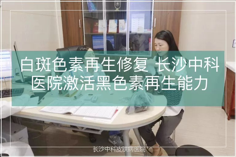 白斑色素再生修复 长沙中科医院激活黑色素再生能力