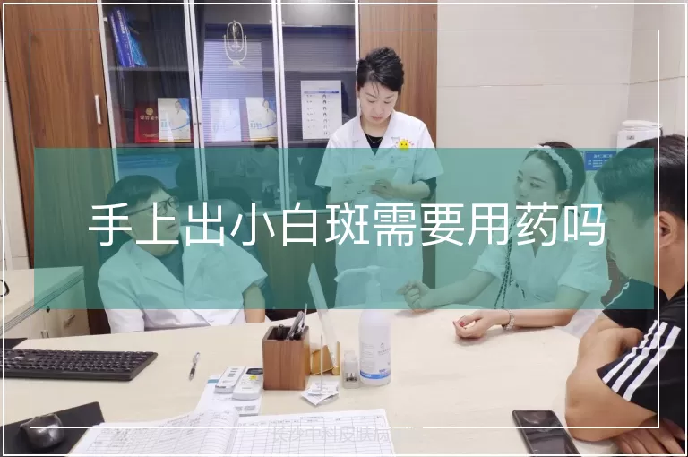 手上出小白斑需要用药吗