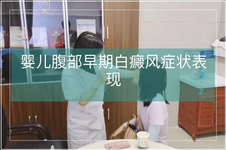 婴儿腹部早期白癜风症状表现
