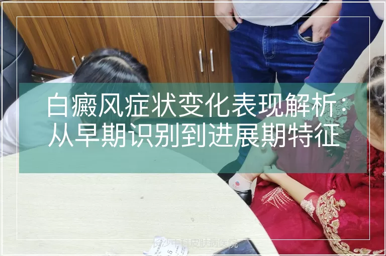 白癜风症状变化表现解析：从早期识别到进展期特征