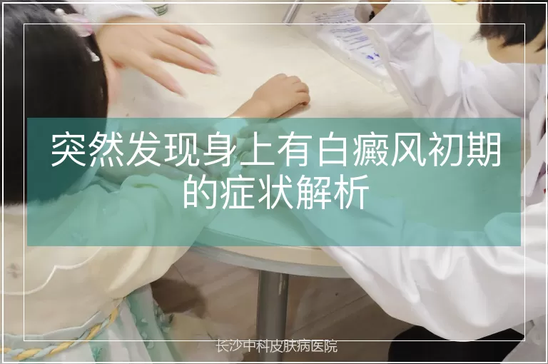 突然发现身上有白癜风初期的症状解析